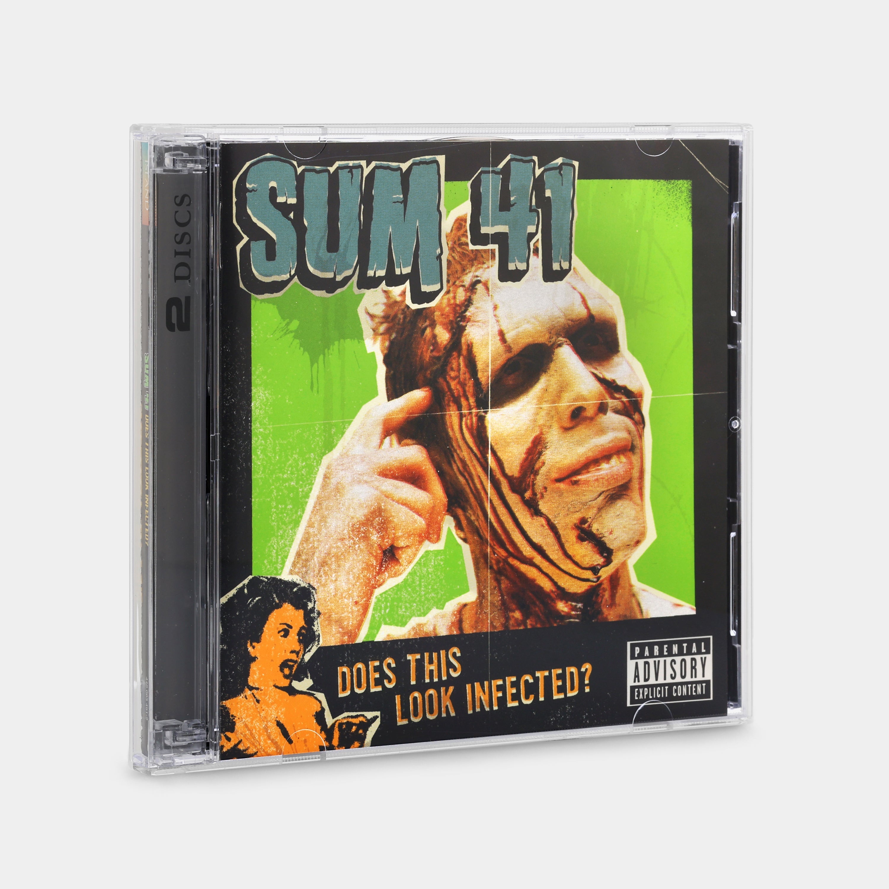Sum 41 - Does This Look Infected? CD + DVD